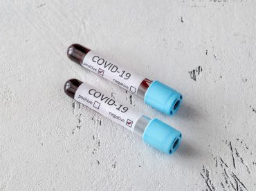 coronavirus-testing-ET8N9RX.jpg